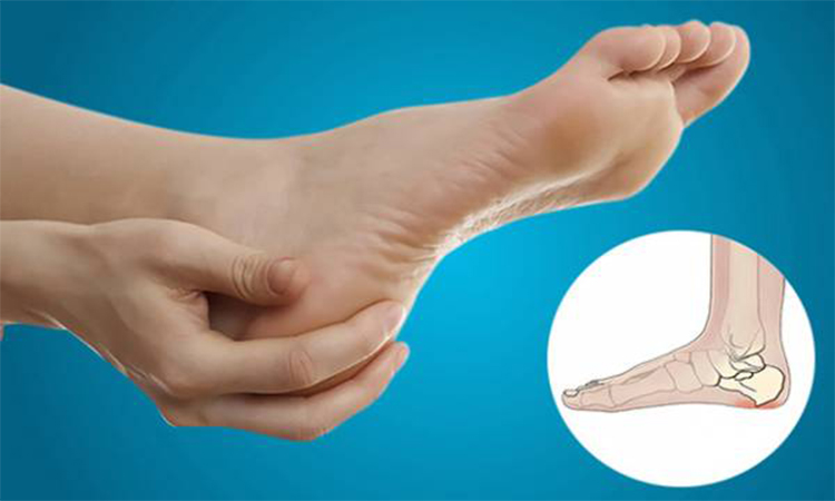 خارپاشنه چیست و تفاوت انواع درمان آن با شاک ویو کف پا چه می باشد؟