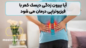 آیا بیرون زدگی دیسک کمر با فیزیوتراپی درمان می شود