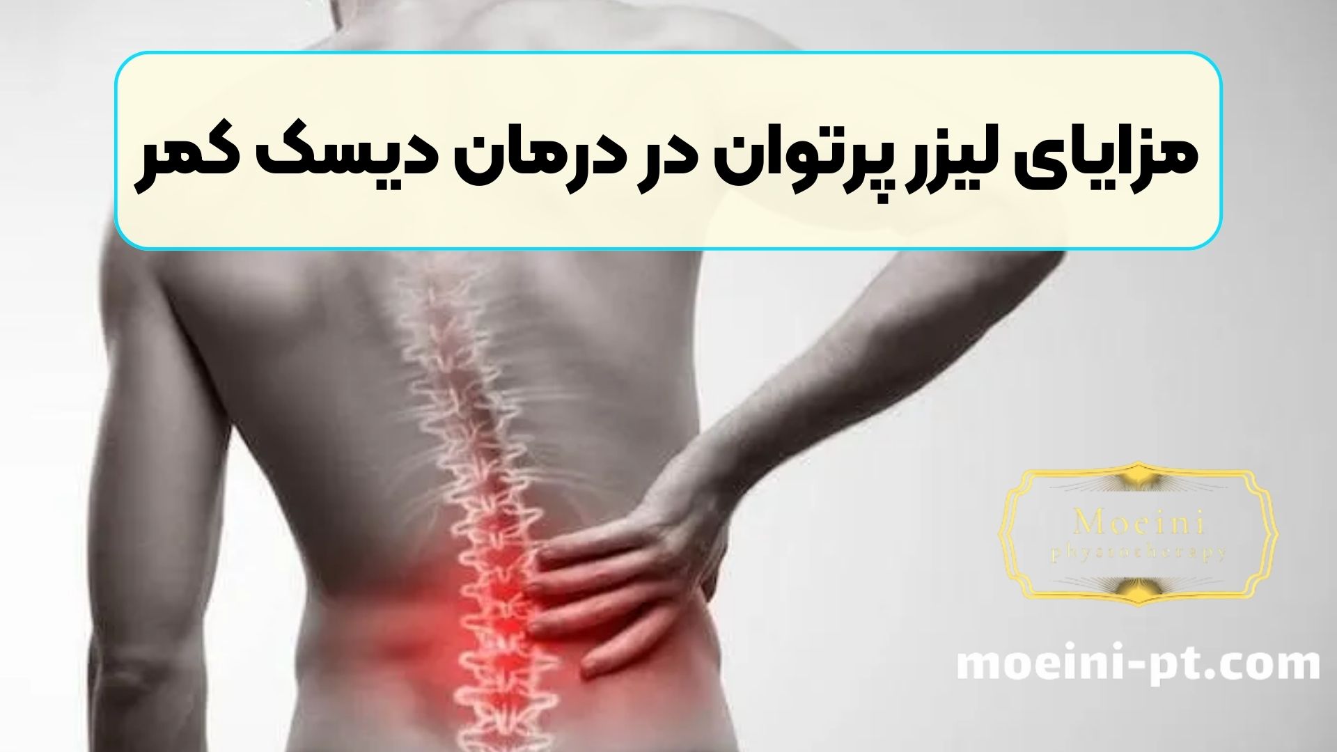 مزایای لیزر پرتوان در درمان دیسک کمر