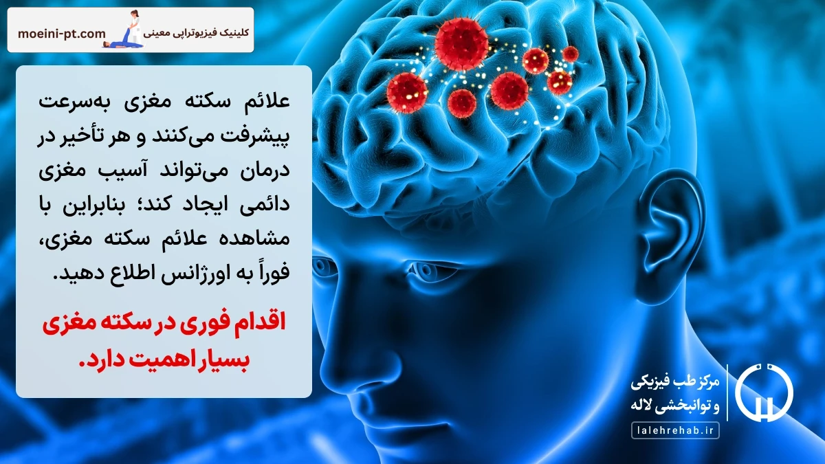 اقدام فوری در سکته مغزی بسیار اهمیت بالایی دارد.