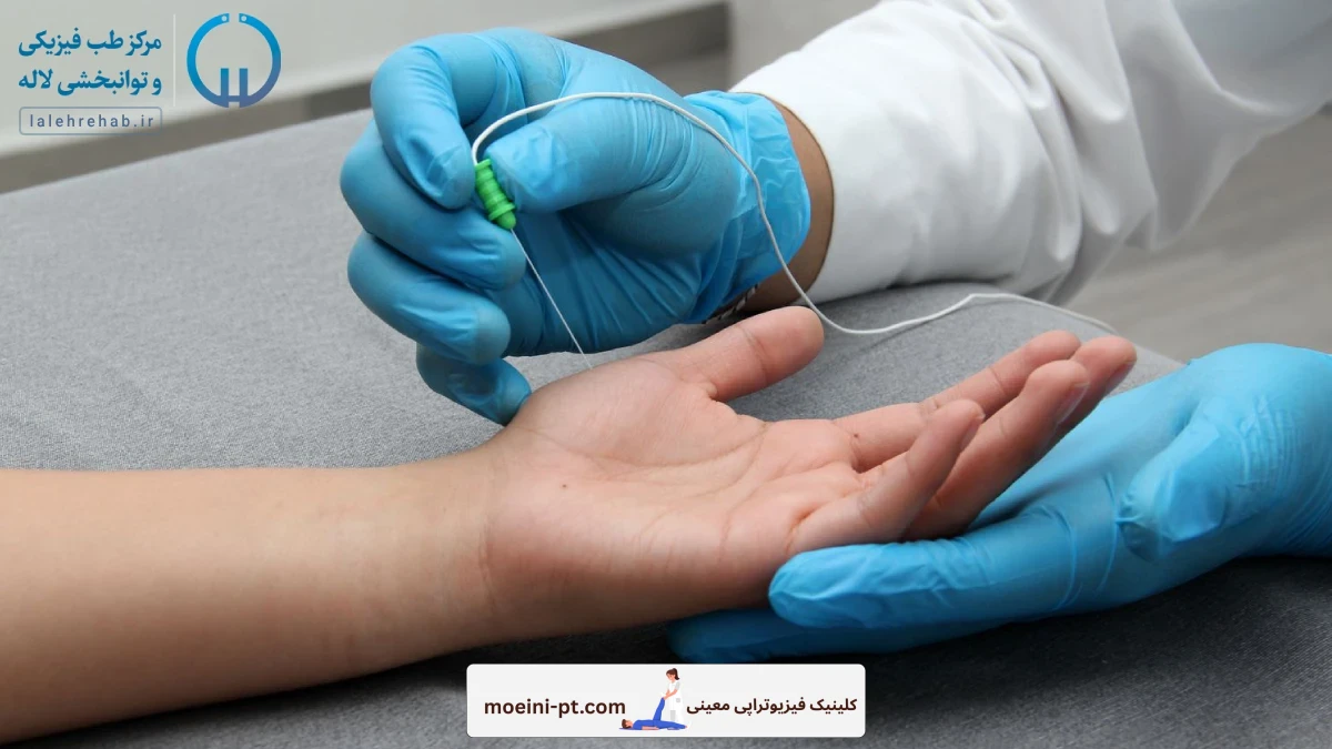 تشخیص نوروپاتی دیابتی با نوار عصب و عضله