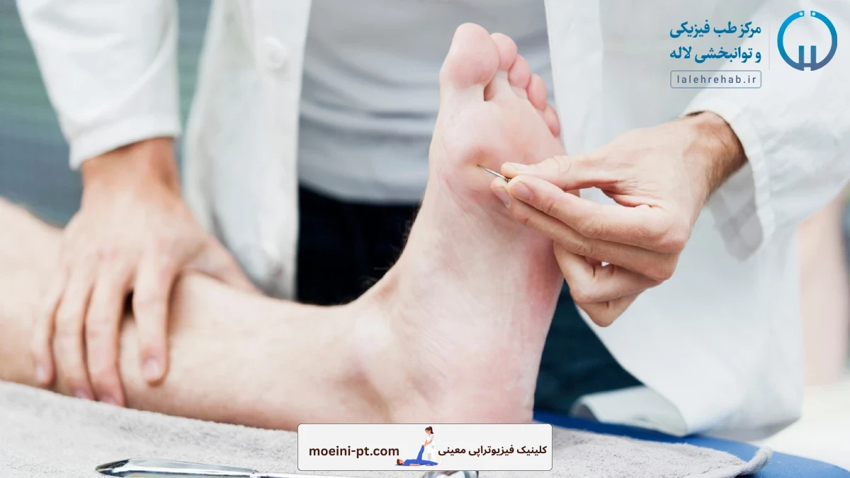 روش‌های تشخیص نوروپاتی دیابتی