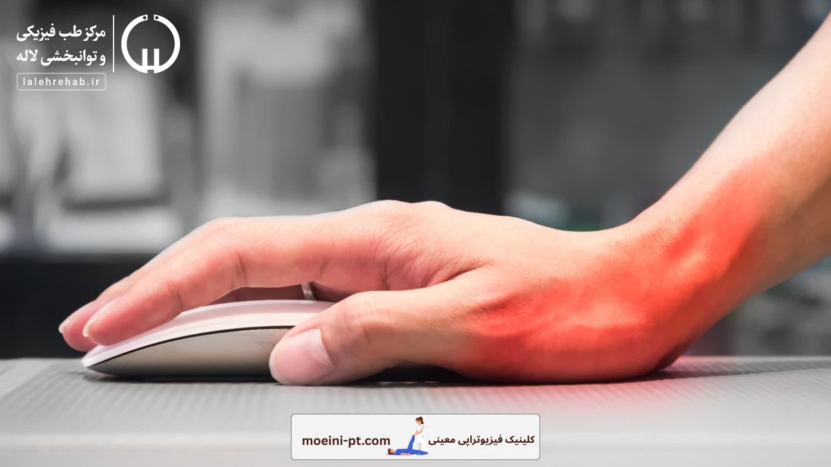 سندرم تونل کارپال