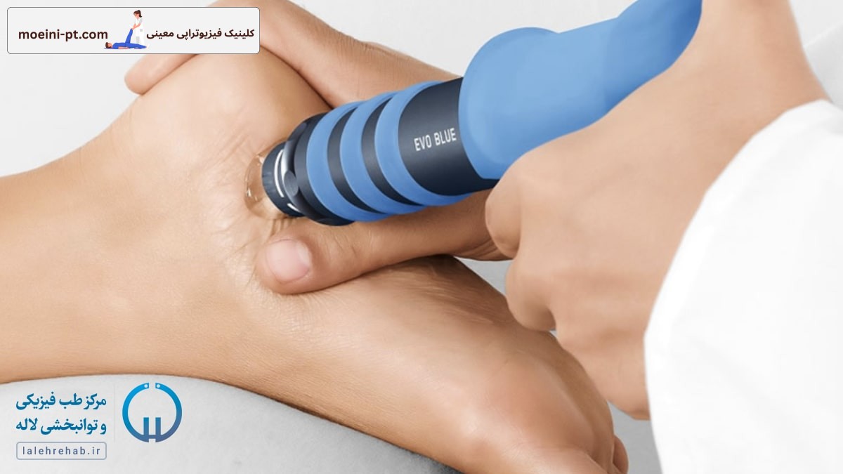 شاک ویو تراپی