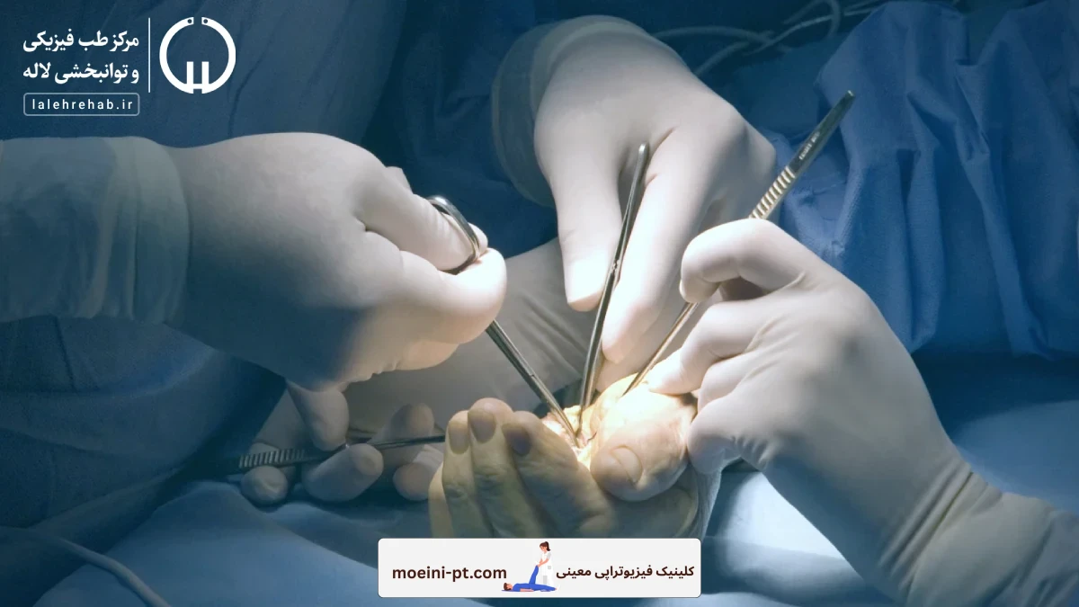 عمل جراحی سندرم تونل کارپال